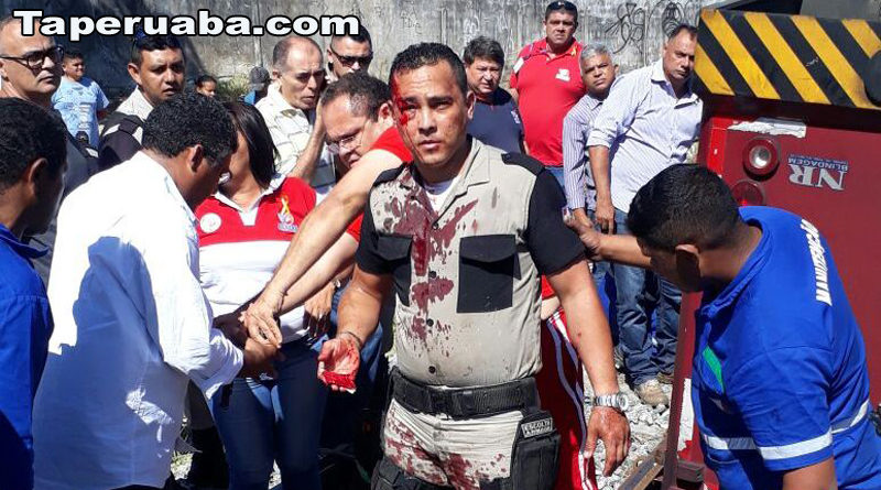 Vigilantes feridos em Fortaleza