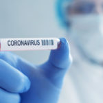 Ceará tem 4.902 óbitos e 79.106 diagnósticos positivos de Covid-19; Sobral soma mais de 4 mil casos