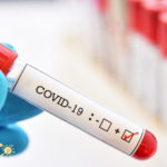 Covid-19: Ceará contabiliza 7.494 óbitos pela doença; número de casos chega a 162.086