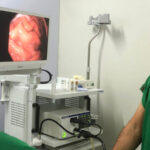 Hospital Municipal Doutor Estevam Ponte inicia realização de exames de endoscopia