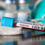 Agência dos EUA aponta que Covid-19 surgiu de vazamento de laboratório chinês